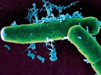 Бацилла сибирской язвы под электронным микроскопом. Фото с сайта bepast.org