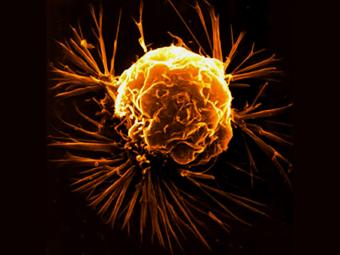 Раковая клетка. Фото с сайта www.odec.ca