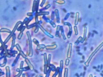 Возбудитель сибирской язвы bacillus anthracis, иллюстрайия с сайта freewebs.com