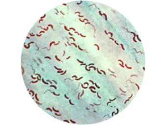 Культура холерных вибрионов. Изображение с сайта nigms.nih.gov