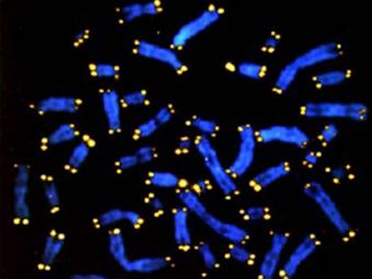Теломеры (желтый цвет) на концах хромосом (синий цвет). Фото с сайта ucla.edu