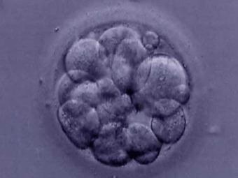 Эмбрион человека на стадии морулы, иллюстрация с сайта hplusbiopolitics.wordpress.com