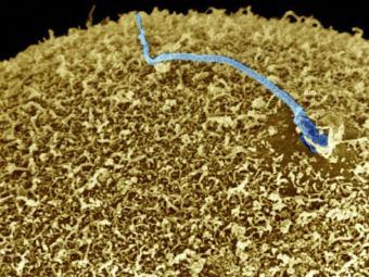 Сперматозоид, оплодотворяющий яйцеклетку, раскрашенная электронная микрофотография с сайта sciencemuseum.org.uk